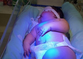 Família de bebê que nasceu com quase 8kg faz campanha para doações